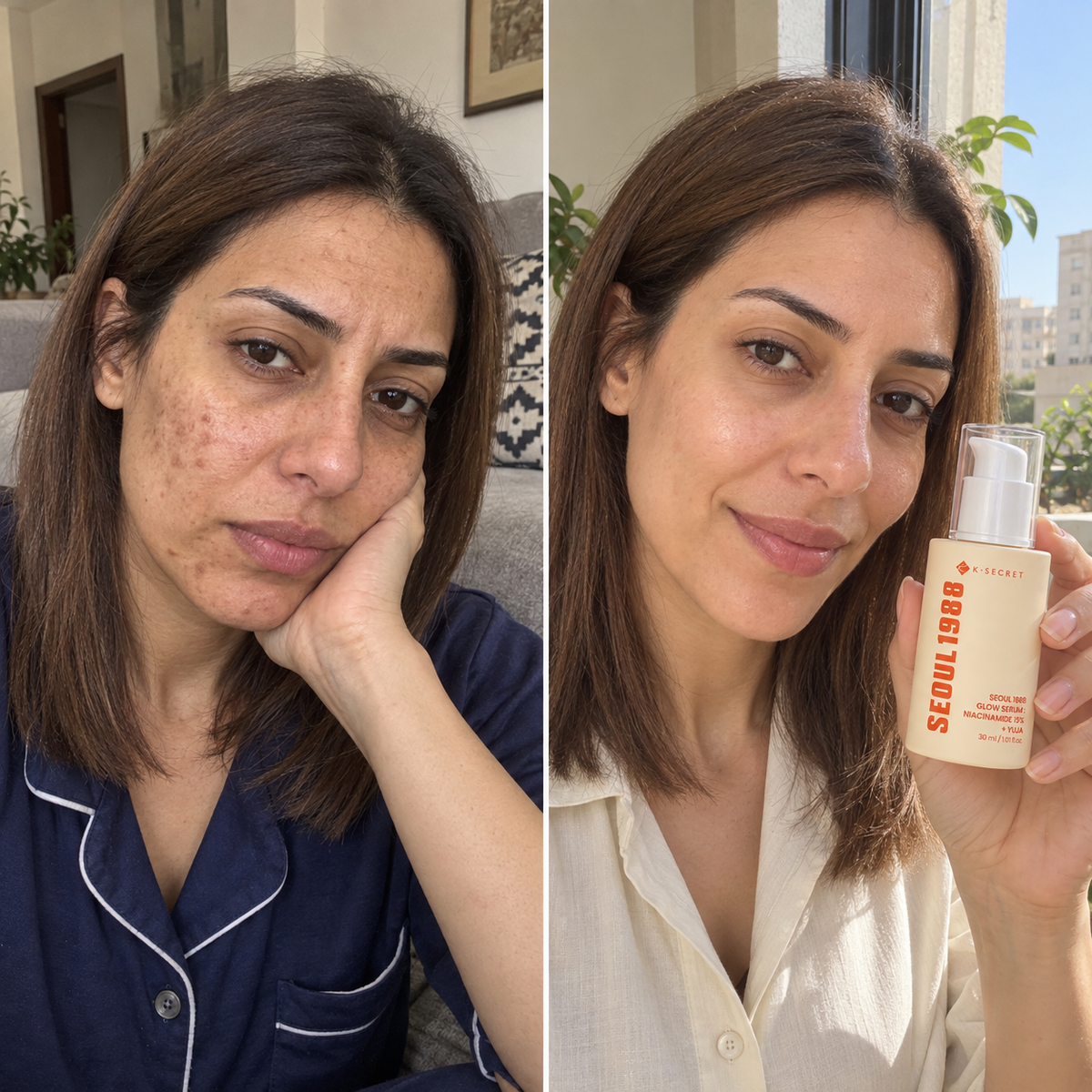 SEOUL 1988 Serum